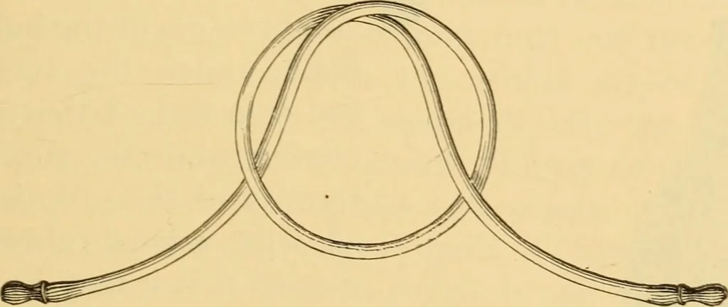 An illustration from Diseases of the ear : a text-book for practitioners and students of medicine / by Edward Bradford Dench., 1900, leaf 141