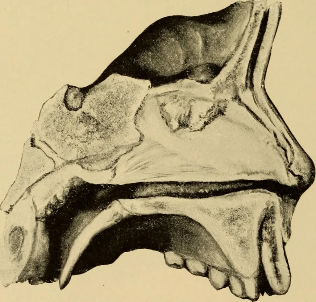 An illustration from Diseases of the ear : a text-book for practitioners and students of medicine / by Edward Bradford Dench., 1900, leaf 158