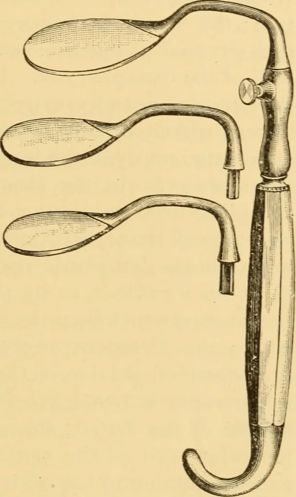 An illustration from Diseases of the ear : a text-book for practitioners and students of medicine / by Edward Bradford Dench., 1900, leaf 175