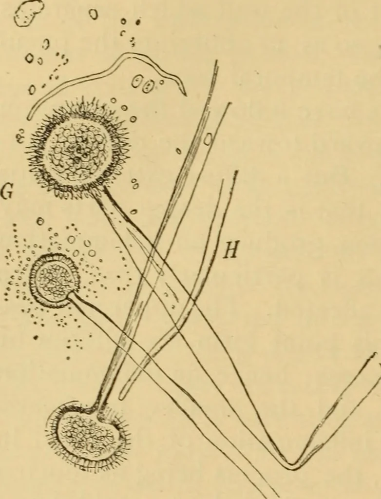 An illustration from Diseases of the ear : a text-book for practitioners and students of medicine / by Edward Bradford Dench., 1900, leaf 280