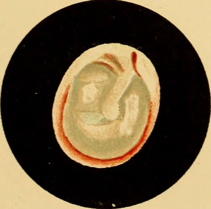 An illustration from Diseases of the ear : a text-book for practitioners and students of medicine / by Edward Bradford Dench., 1900, leaf 337