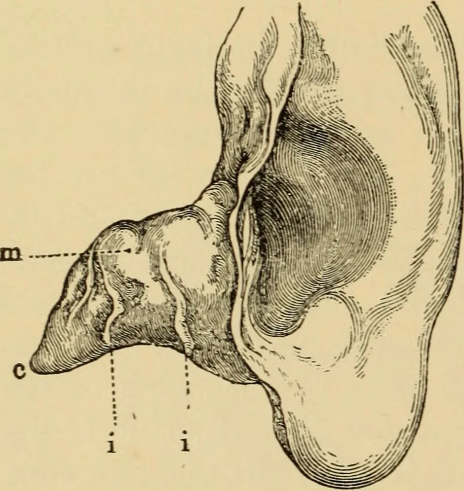 An illustration from Diseases of the ear : a text-book for practitioners and students of medicine / by Edward Bradford Dench., 1900, leaf 36