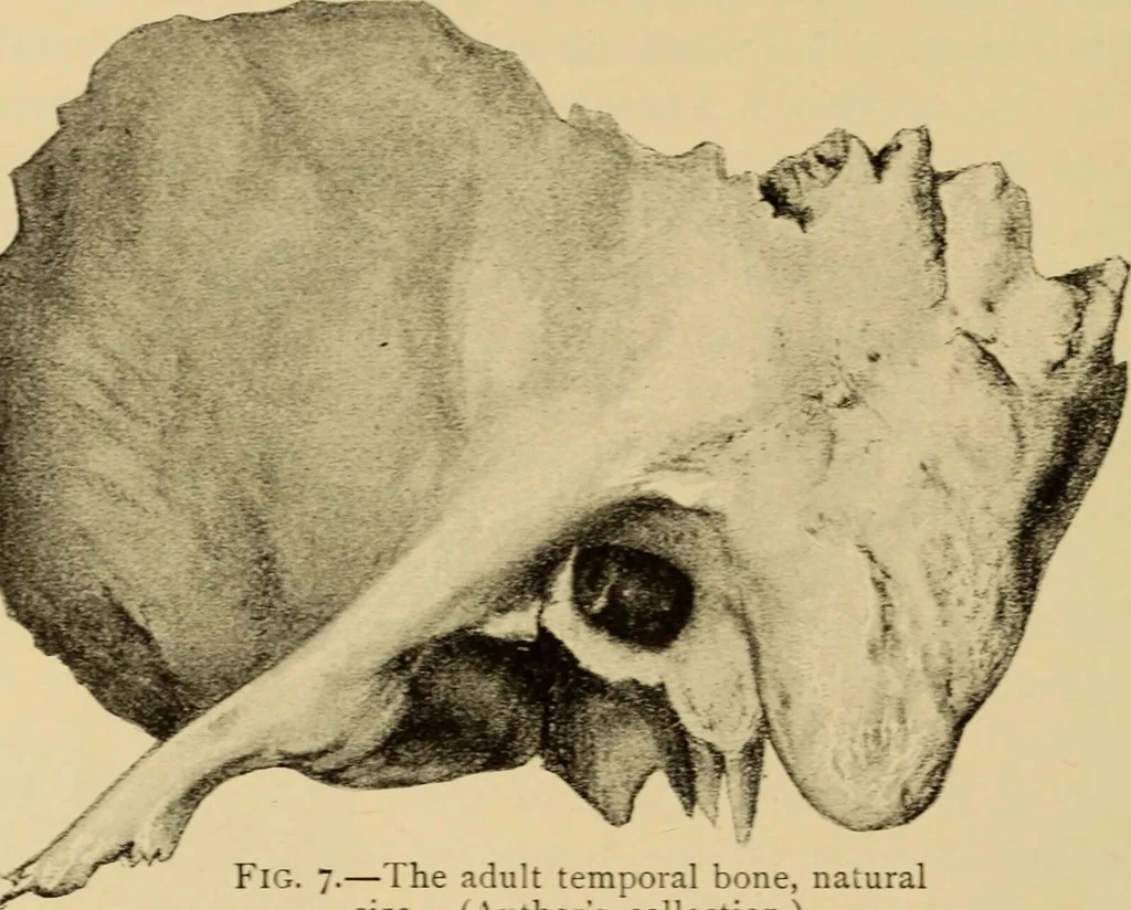 An illustration from Diseases of the ear : a text-book for practitioners and students of medicine / by Edward Bradford Dench., 1900, leaf 40