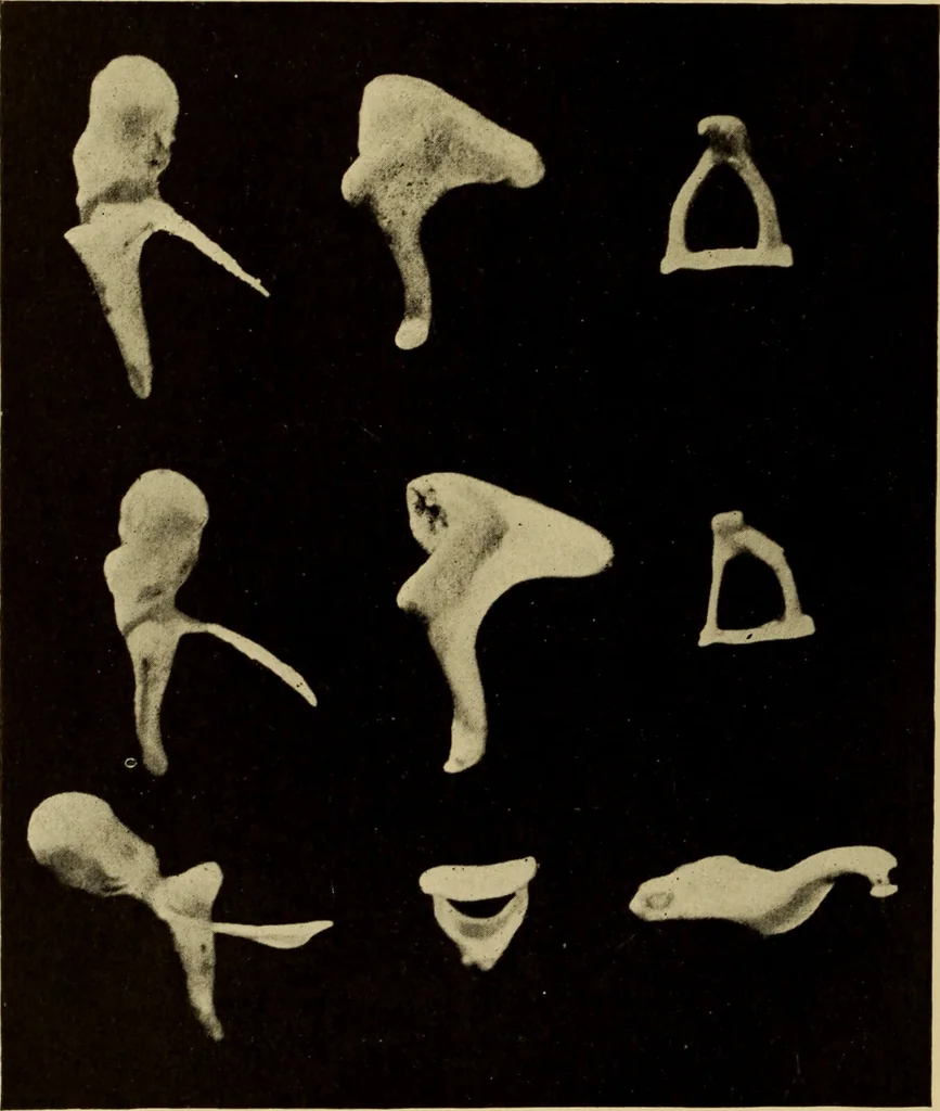 An illustration from Diseases of the ear : a text-book for practitioners and students of medicine / by Edward Bradford Dench., 1900, leaf 46