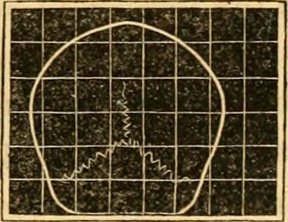 An illustration from A system of phrenology / by George Combe., 1830, leaf 199