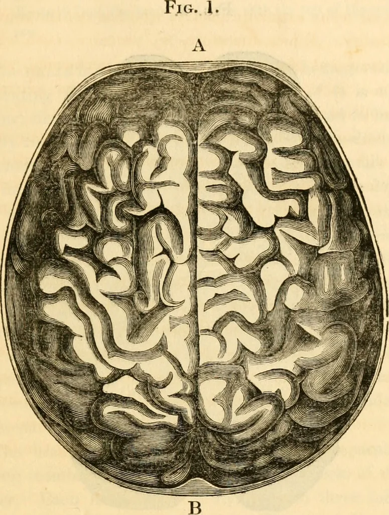 An illustration from A system of phrenology / by George Combe., 1830, leaf 93