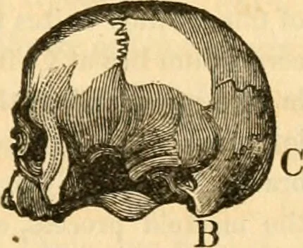 An illustration from A system of phrenology / by George Combe., 1830, leaf 99