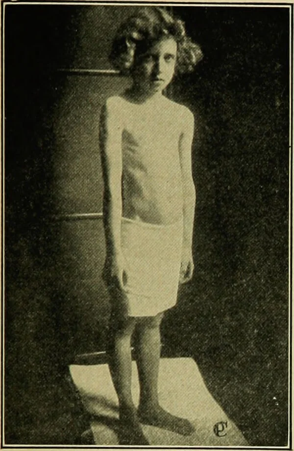 An illustration from Diseases of infants and children / by Henry Dwight Chapin and Godfrey Roger Pisek ; with 181 ill. and eleven colored plates., 1911, leaf 129
