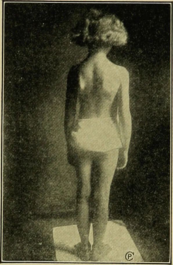 An illustration from Diseases of infants and children / by Henry Dwight Chapin and Godfrey Roger Pisek ; with 181 ill. and eleven colored plates., 1911, leaf 129