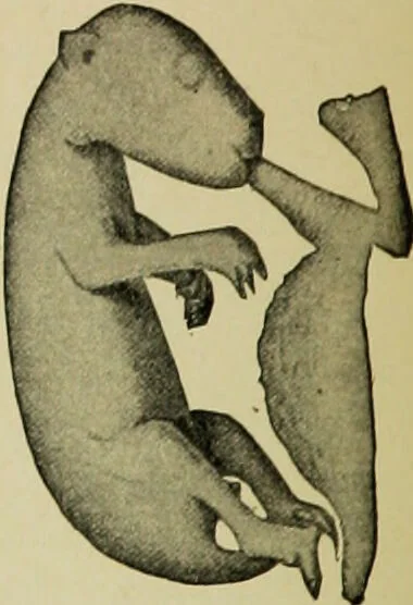 An illustration from Diseases of infants and children / by Henry Dwight Chapin and Godfrey Roger Pisek ; with 181 ill. and eleven colored plates., 1911, leaf 142