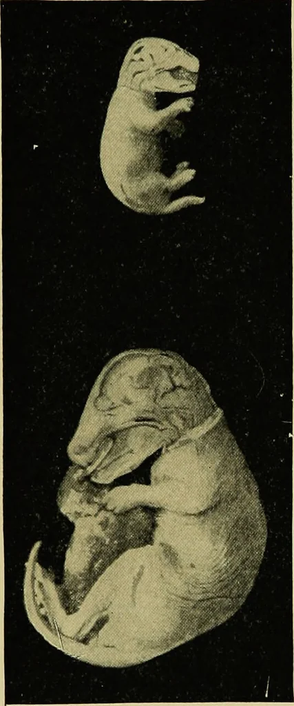 An illustration from Diseases of infants and children / by Henry Dwight Chapin and Godfrey Roger Pisek ; with 181 ill. and eleven colored plates., 1911, leaf 143