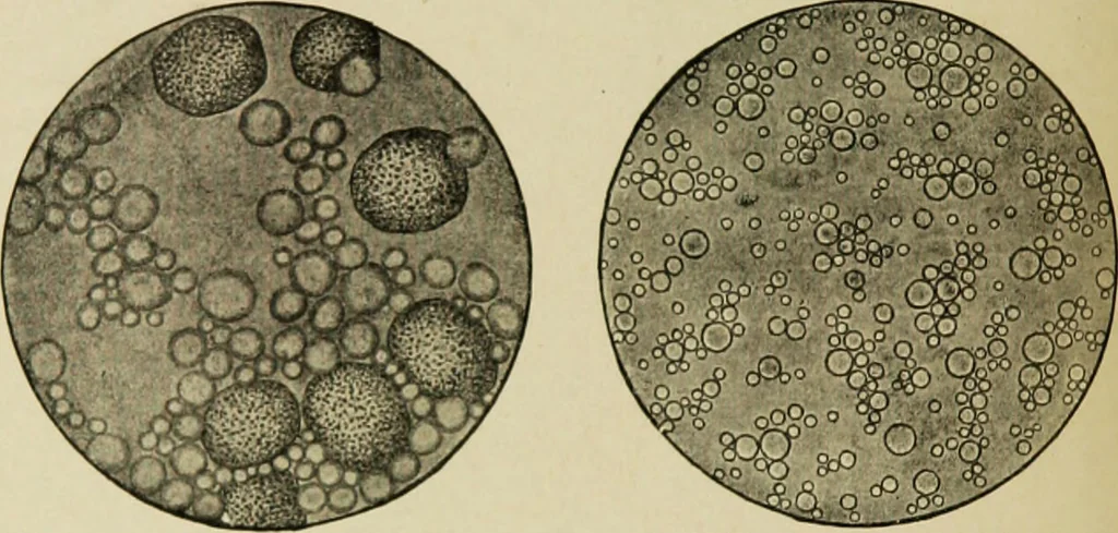 An illustration from Diseases of infants and children / by Henry Dwight Chapin and Godfrey Roger Pisek ; with 181 ill. and eleven colored plates., 1911, leaf 144