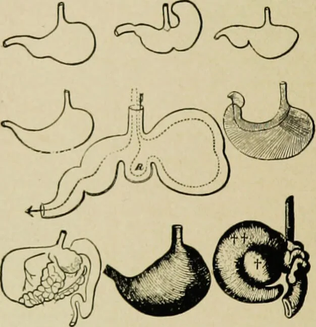 An illustration from Diseases of infants and children / by Henry Dwight Chapin and Godfrey Roger Pisek ; with 181 ill. and eleven colored plates., 1911, leaf 146