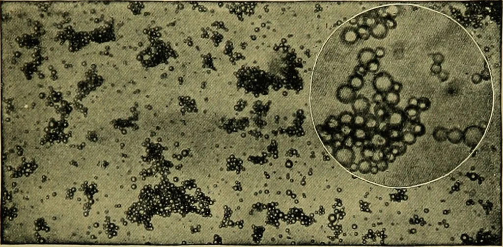 An illustration from Diseases of infants and children / by Henry Dwight Chapin and Godfrey Roger Pisek ; with 181 ill. and eleven colored plates., 1911, leaf 169