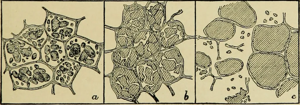 An illustration from Diseases of infants and children / by Henry Dwight Chapin and Godfrey Roger Pisek ; with 181 ill. and eleven colored plates., 1911, leaf 227