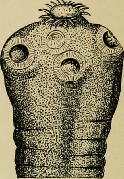 An illustration from Diseases of infants and children / by Henry Dwight Chapin and Godfrey Roger Pisek ; with 181 ill. and eleven colored plates., 1911, leaf 272