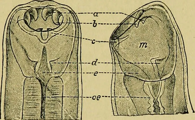 An illustration from Diseases of infants and children / by Henry Dwight Chapin and Godfrey Roger Pisek ; with 181 ill. and eleven colored plates., 1911, leaf 275