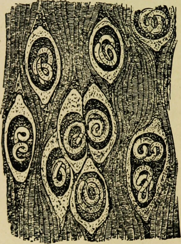 An illustration from Diseases of infants and children / by Henry Dwight Chapin and Godfrey Roger Pisek ; with 181 ill. and eleven colored plates., 1911, leaf 276