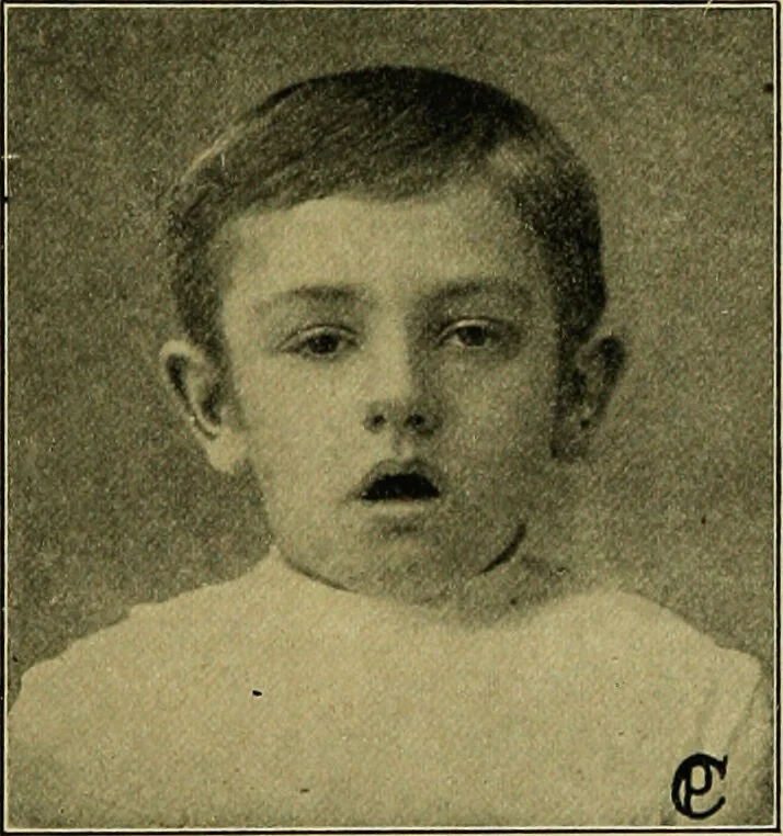 An illustration from Diseases of infants and children / by Henry Dwight Chapin and Godfrey Roger Pisek ; with 181 ill. and eleven colored plates., 1911, leaf 421