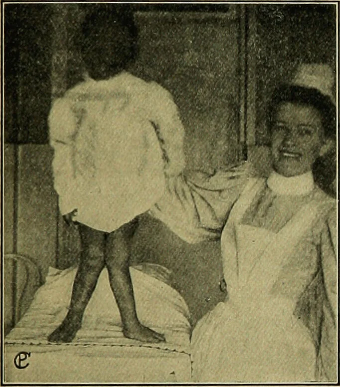 An illustration from Diseases of infants and children / by Henry Dwight Chapin and Godfrey Roger Pisek ; with 181 ill. and eleven colored plates., 1911, leaf 505