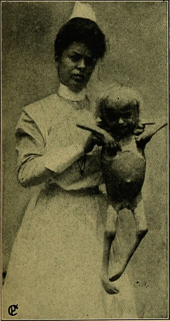 An illustration from Diseases of infants and children / by Henry Dwight Chapin and Godfrey Roger Pisek ; with 181 ill. and eleven colored plates., 1911, leaf 511