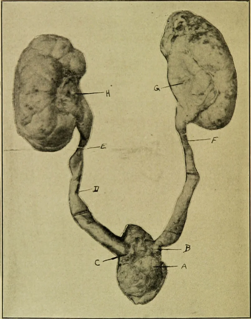 An illustration from Diseases of infants and children / by Henry Dwight Chapin and Godfrey Roger Pisek ; with 181 ill. and eleven colored plates., 1911, leaf 538