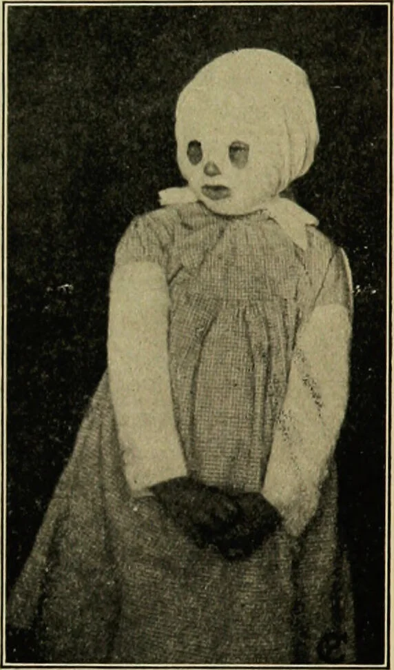An illustration from Diseases of infants and children / by Henry Dwight Chapin and Godfrey Roger Pisek ; with 181 ill. and eleven colored plates., 1911, leaf 654