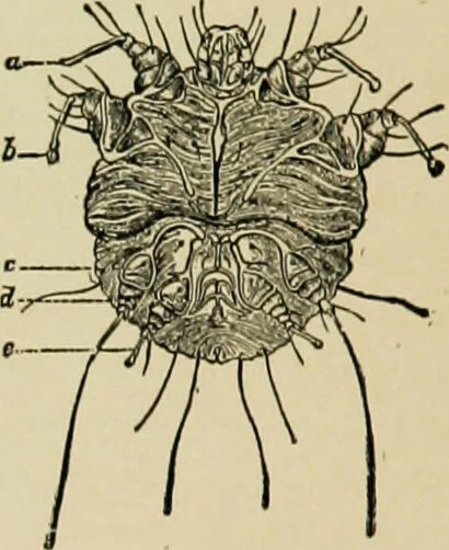 An illustration from Diseases of infants and children / by Henry Dwight Chapin and Godfrey Roger Pisek ; with 181 ill. and eleven colored plates., 1911, leaf 660