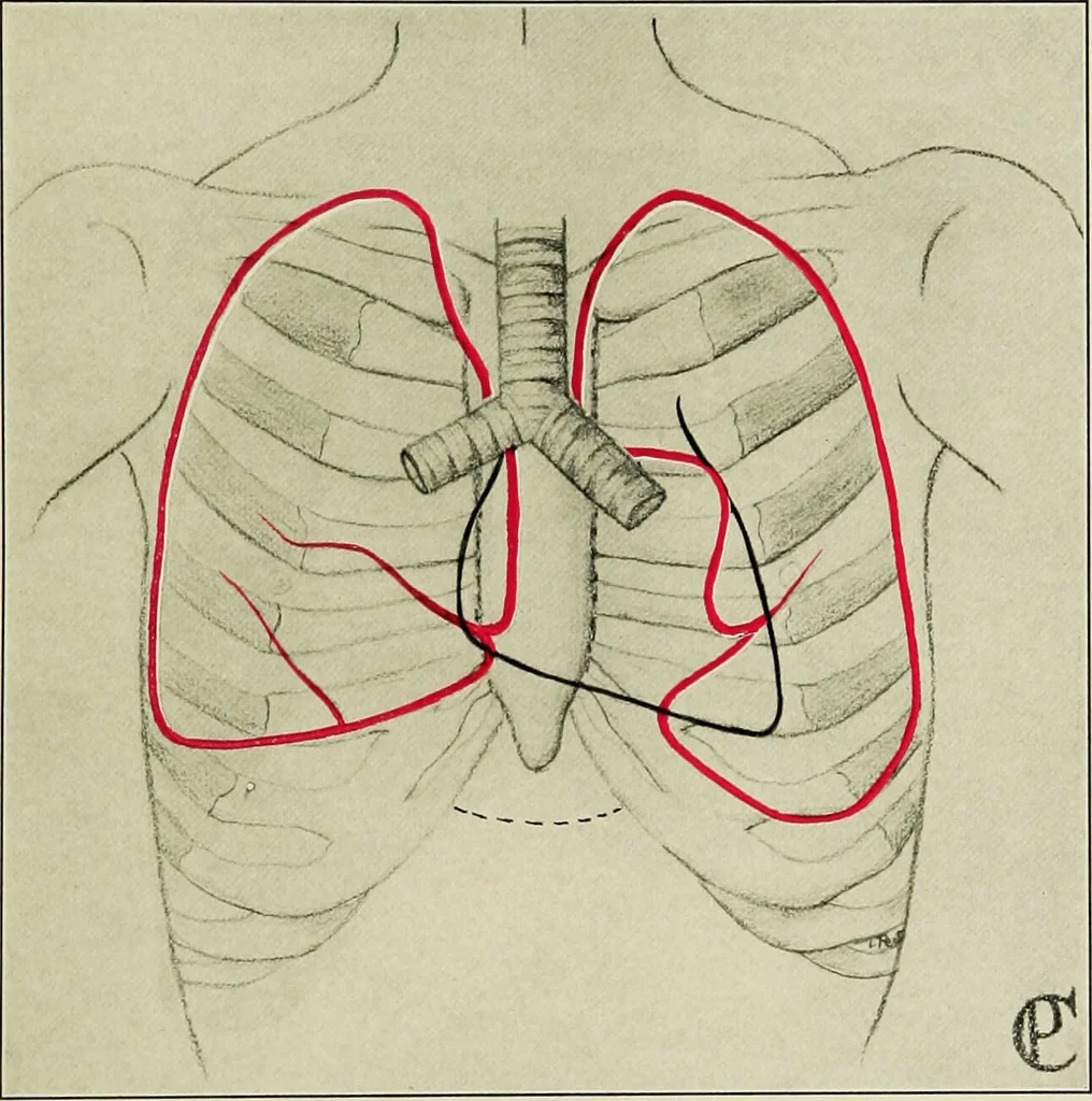 An illustration from Diseases of infants and children / by Henry Dwight Chapin and Godfrey Roger Pisek ; with 181 ill. and eleven colored plates., 1911, leaf 73