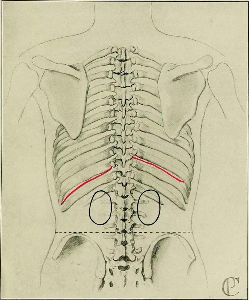 An illustration from Diseases of infants and children / by Henry Dwight Chapin and Godfrey Roger Pisek ; with 181 ill. and eleven colored plates., 1911, leaf 75