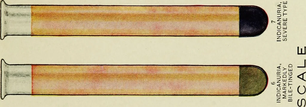 An illustration from Diseases of infants and children / by Henry Dwight Chapin and Godfrey Roger Pisek ; with 181 ill. and eleven colored plates., 1911, leaf 85
