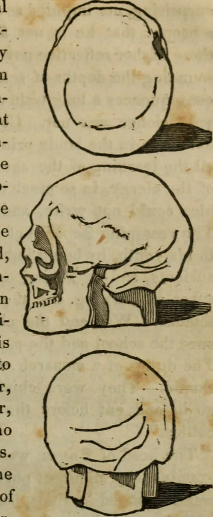 An illustration from Illustrations of phrenology : being a selection of articles from the Edinburg phrenological journal, and the transactions of the Edinburg Phrenological Society. With twenty-six wood cuts / Ed. by George H. Calvert. With an introduction by the editor., 1832, leaf 117