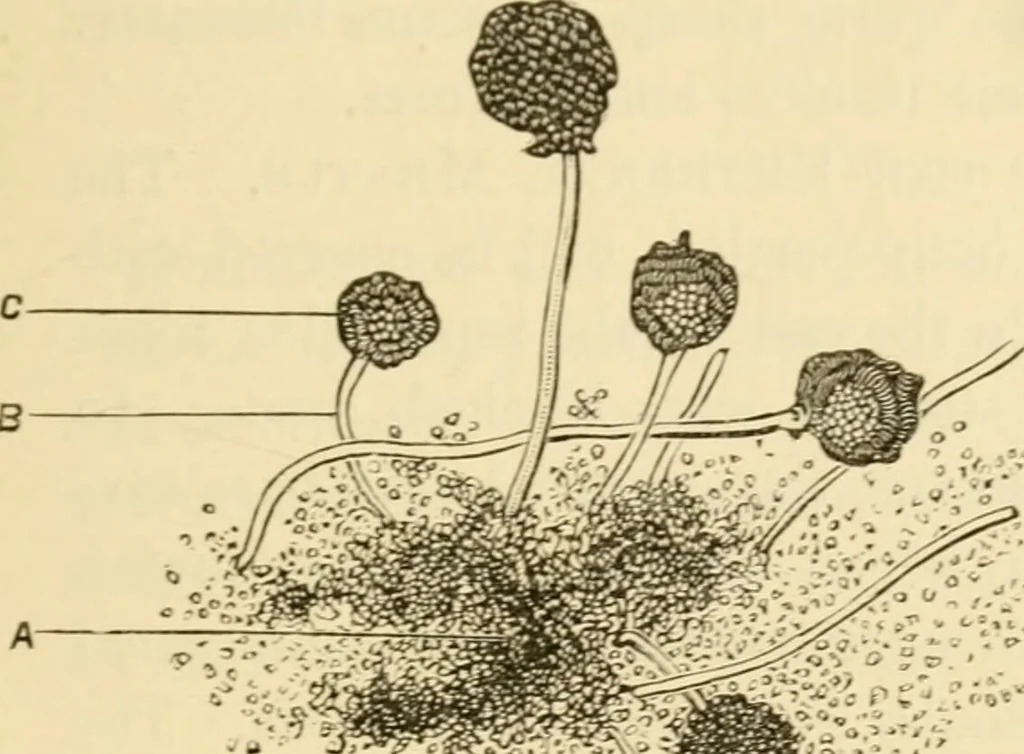 An illustration from A manual of otology / By Gorham Bacon ... With an introductory chapter by Clarence John Blake ... With 110 illustrations and a colored plate., 1898, leaf 111
