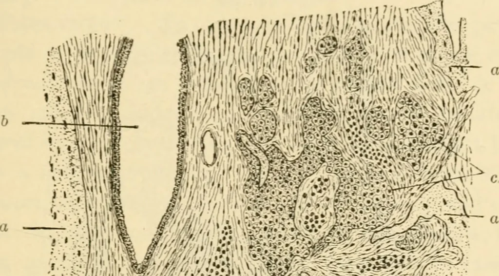 An illustration from A manual of otology / By Gorham Bacon ... With an introductory chapter by Clarence John Blake ... With 110 illustrations and a colored plate., 1898, leaf 153