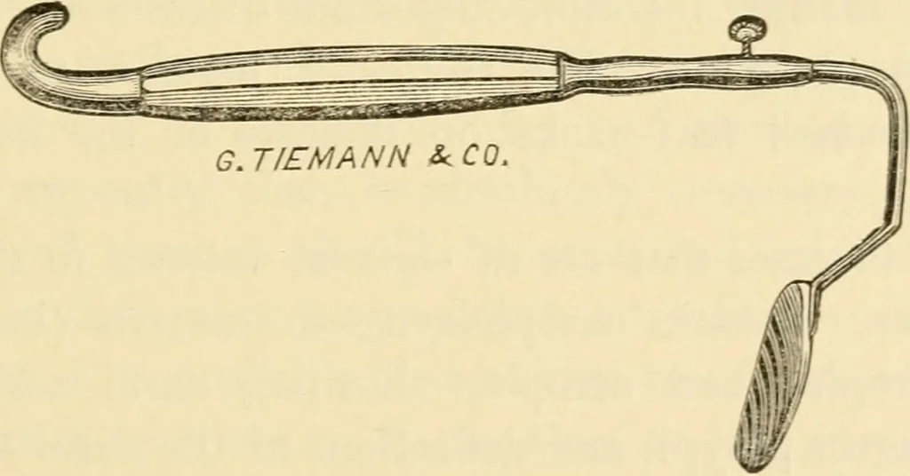 An illustration from A manual of otology / By Gorham Bacon ... With an introductory chapter by Clarence John Blake ... With 110 illustrations and a colored plate., 1898, leaf 177
