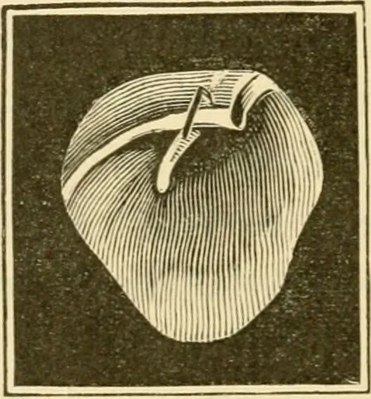 An illustration from A manual of otology / By Gorham Bacon ... With an introductory chapter by Clarence John Blake ... With 110 illustrations and a colored plate., 1898, leaf 218