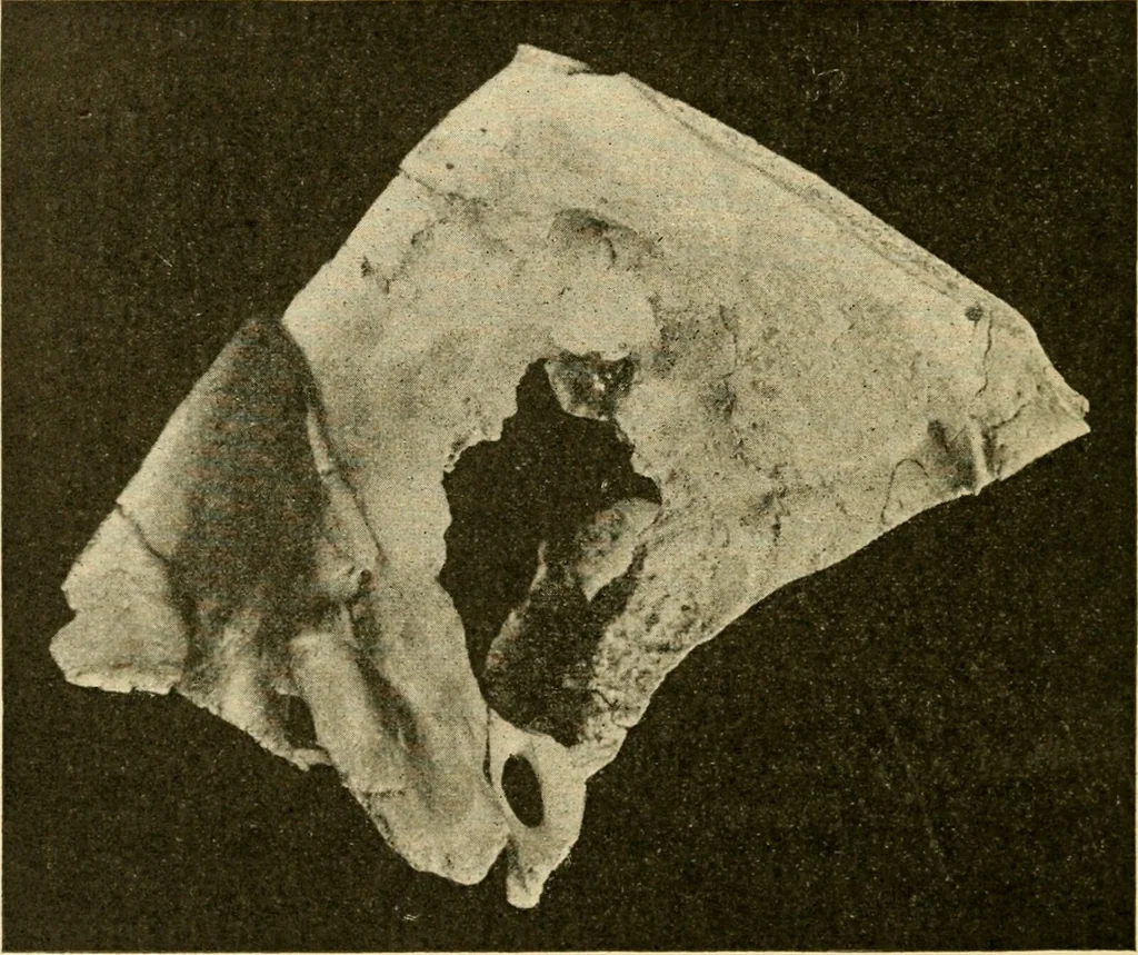 An illustration from A manual of otology / By Gorham Bacon ... With an introductory chapter by Clarence John Blake ... With 110 illustrations and a colored plate., 1898, leaf 270