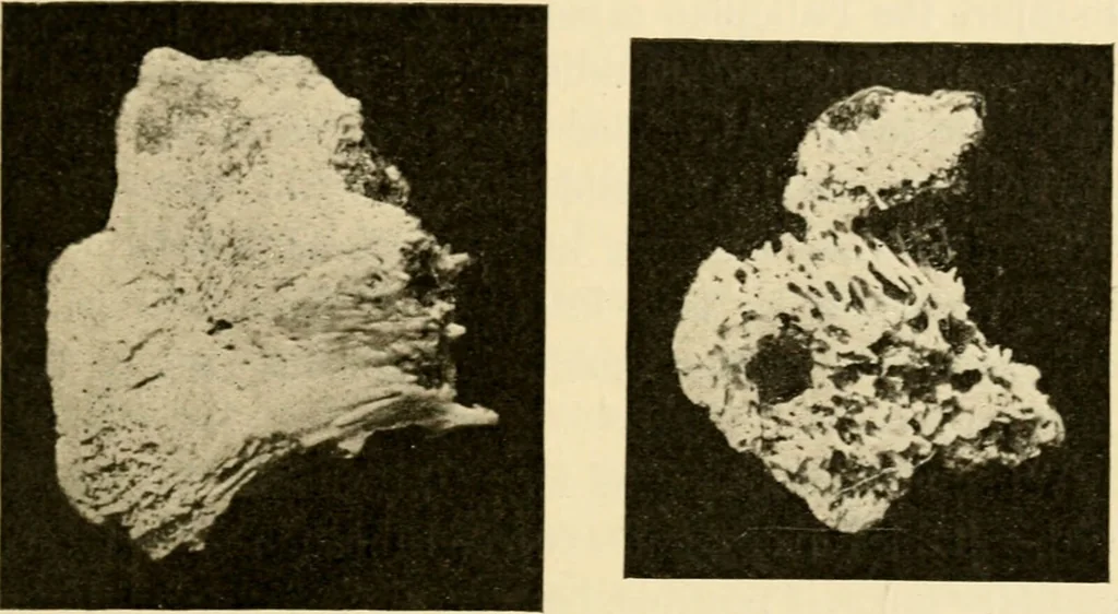 An illustration from A manual of otology / By Gorham Bacon ... With an introductory chapter by Clarence John Blake ... With 110 illustrations and a colored plate., 1898, leaf 273