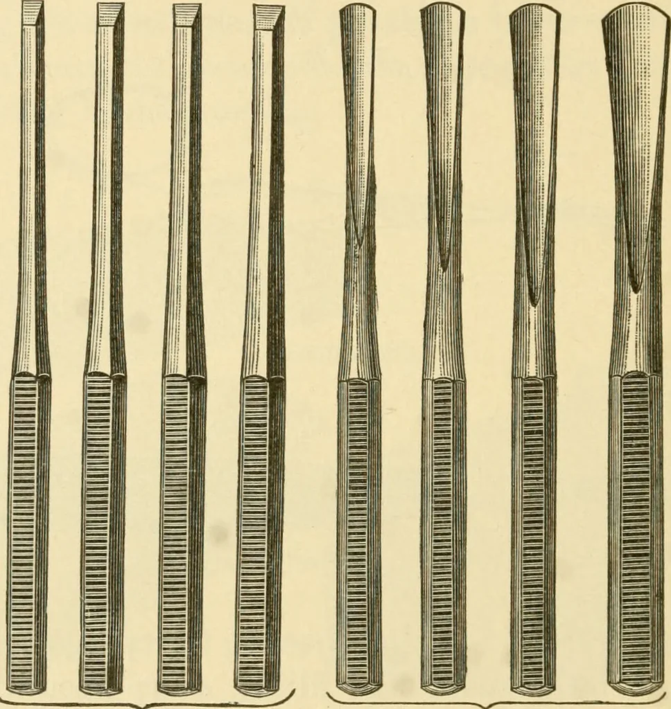 An illustration from A manual of otology / By Gorham Bacon ... With an introductory chapter by Clarence John Blake ... With 110 illustrations and a colored plate., 1898, leaf 304