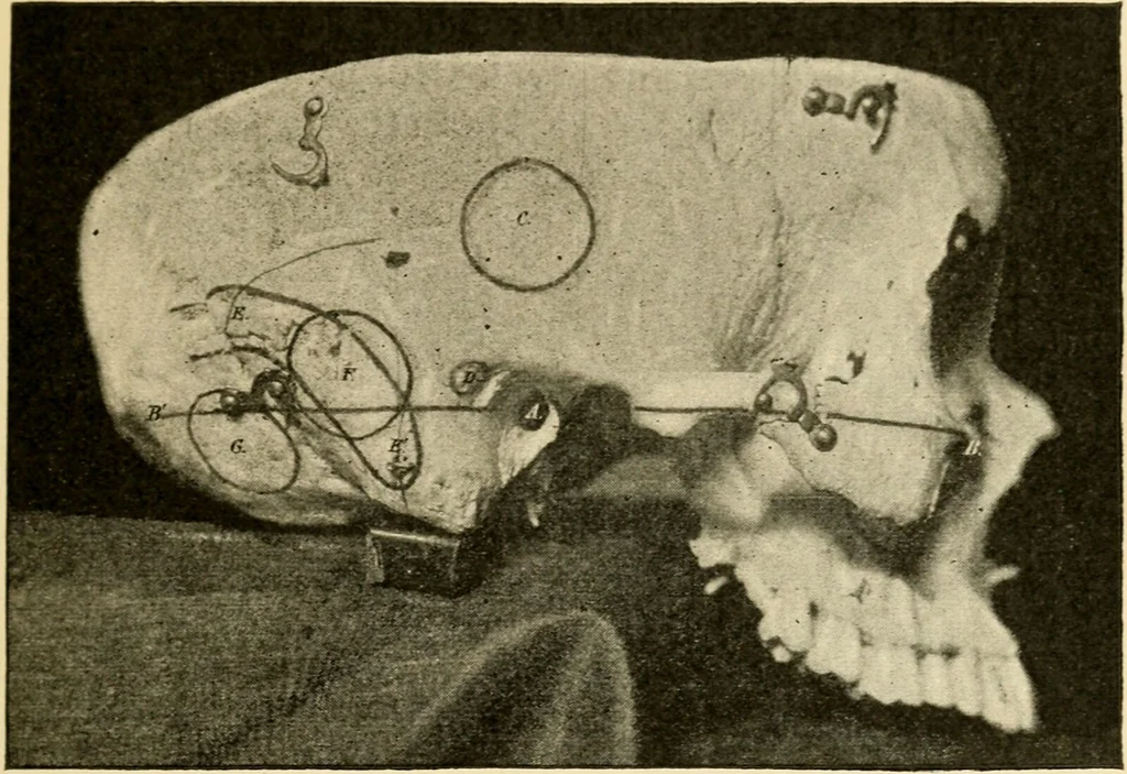 An illustration from A manual of otology / By Gorham Bacon ... With an introductory chapter by Clarence John Blake ... With 110 illustrations and a colored plate., 1898, leaf 331