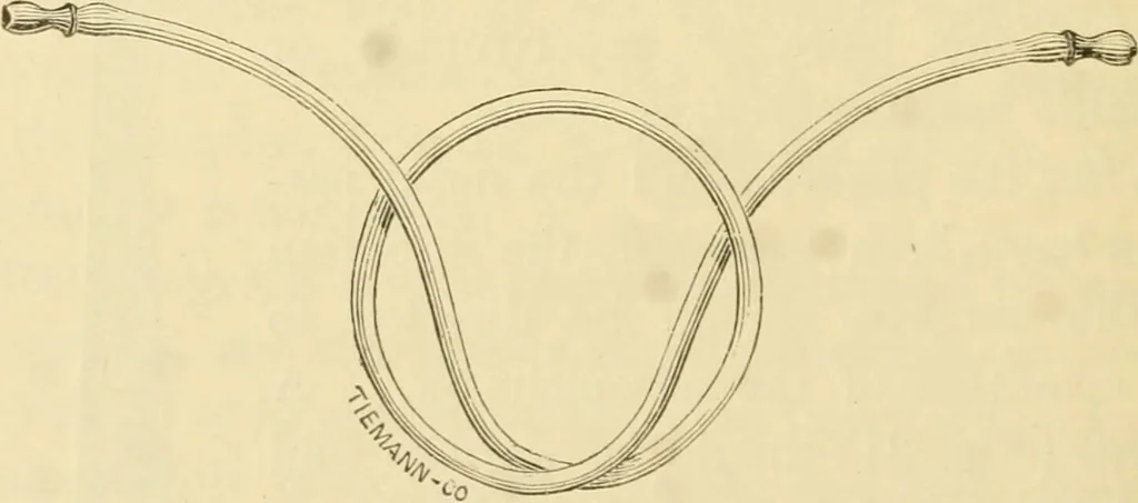 An illustration from A manual of otology / By Gorham Bacon ... With an introductory chapter by Clarence John Blake ... With 110 illustrations and a colored plate., 1898, leaf 72