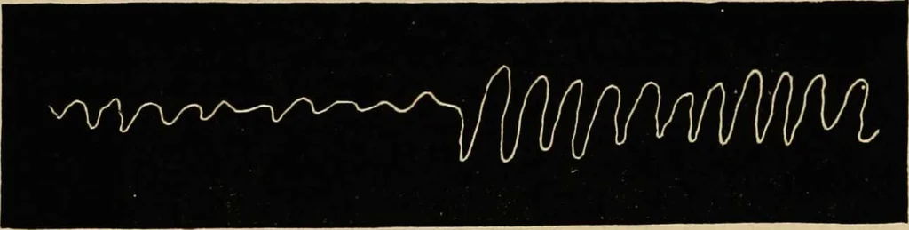 An illustration from Ladies' guide in health and disease : girlhood, maidenhood, wifehood, motherhood / by J.H. Kellogg., 1892, leaf 296