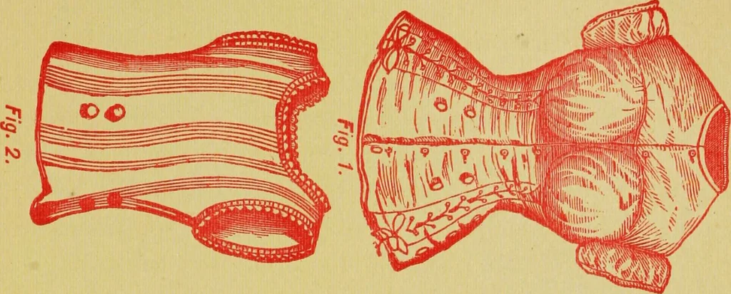 An illustration from Ladies' guide in health and disease : girlhood, maidenhood, wifehood, motherhood / by J.H. Kellogg., 1892, leaf 304