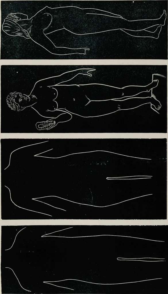 An illustration from Ladies' guide in health and disease : girlhood, maidenhood, wifehood, motherhood / by J.H. Kellogg., 1892, leaf 313