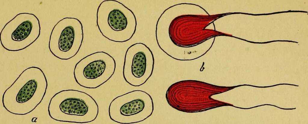 An illustration from Ladies' guide in health and disease : girlhood, maidenhood, wifehood, motherhood / by J.H. Kellogg., 1892, leaf 38
