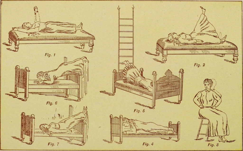 An illustration from Ladies' guide in health and disease : girlhood, maidenhood, wifehood, motherhood / by J.H. Kellogg., 1892, leaf 690