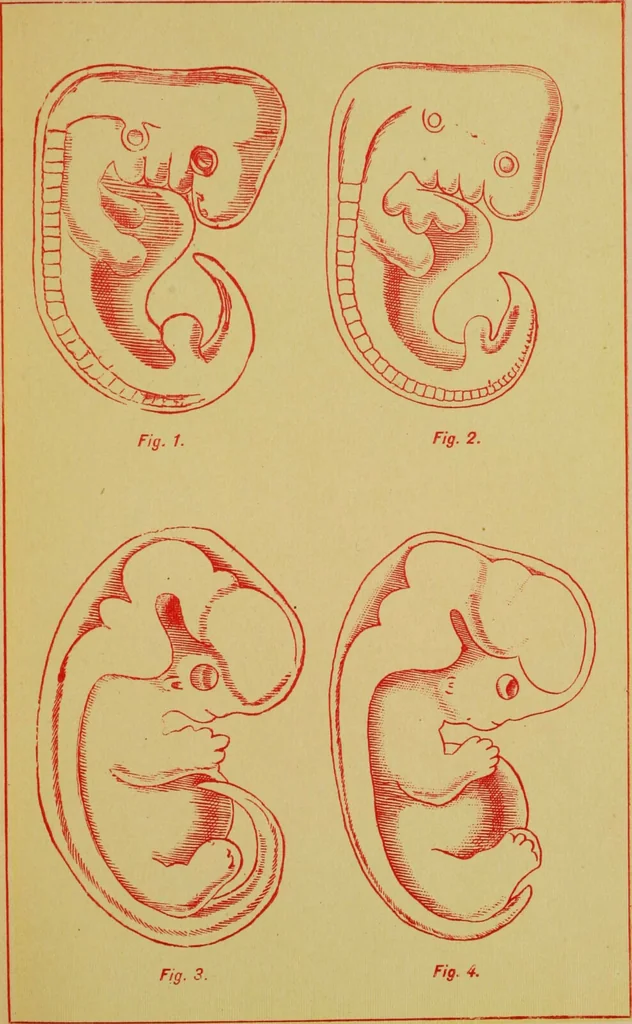 An illustration from Ladies' guide in health and disease : girlhood, maidenhood, wifehood, motherhood / by J.H. Kellogg., 1892, leaf 744
