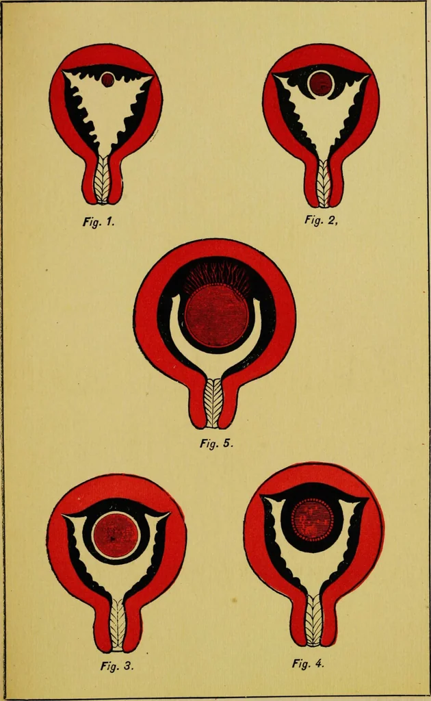 An illustration from Ladies' guide in health and disease : girlhood, maidenhood, wifehood, motherhood / by J.H. Kellogg., 1892, leaf 750