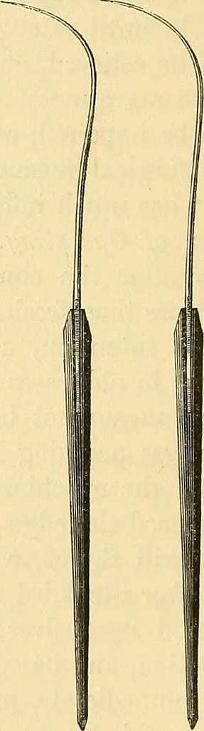 An illustration from On some diseases of women admitting of surgical treatment / by Isaac Baker Brown ; illustrated by coloured plates and wood engravings., 1854, leaf 50