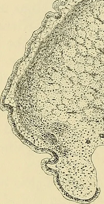 An illustration from Diseases of the nose and throat / by J. Price-Brown ; ill. with 159 engravings, including 6 full-page color-plates and 9 color-cuts in the text, many of them original., 1900, leaf 144